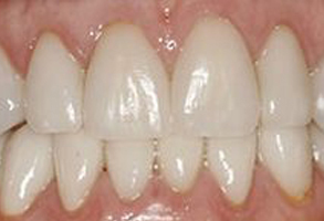 Sajoo Smiles | Dentures, Periodontal Treatment and Teeth Whitening
