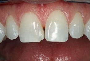 Sajoo Smiles | Root Canals, Oral Exams and Periodontal Treatment